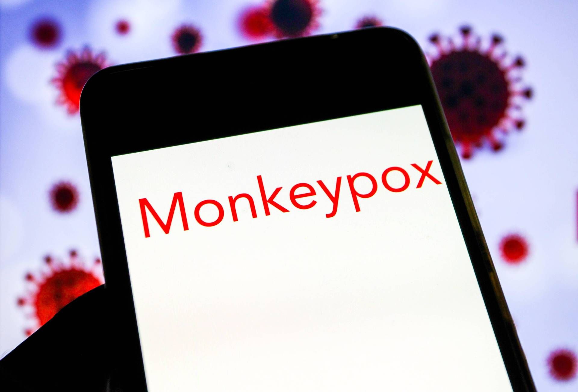 vaiolo scimmie vaiolo scimmie