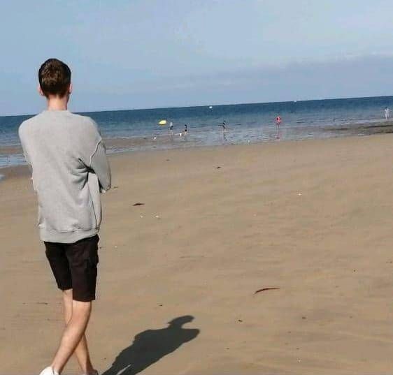 malattia lafora malattia lafora