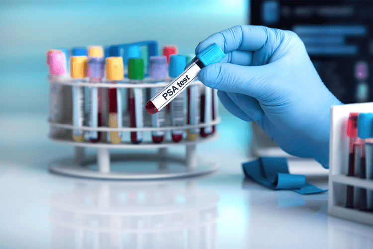 Tumori, 22 pesticidi collegati al cancro della prostata: 4 quelli mortali Tumori, 22 pesticidi collegati al cancro della prostata: 4 quelli mortali