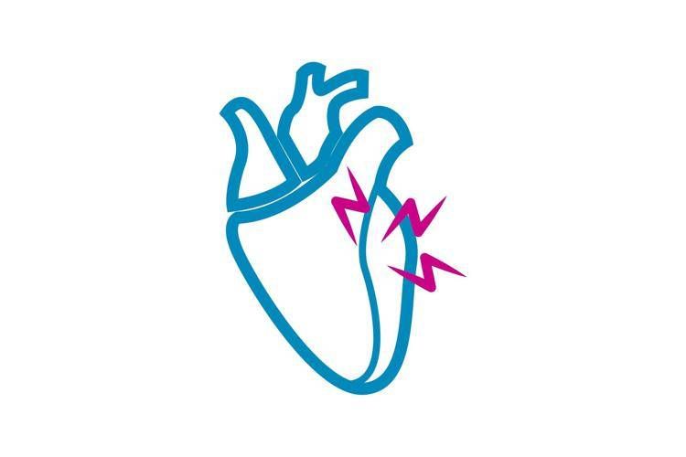 Riproduzione di un cuore con problemi  - ()