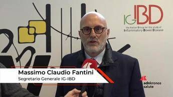 Fantini: “Le Raccomandazioni italiane sugli Standard di Qualità delle Cure per le MICI”