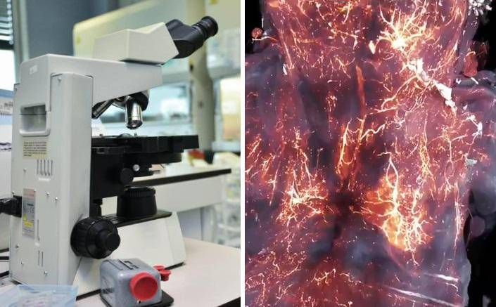 Spike proteini beyinde kalır