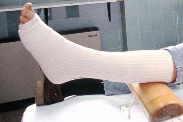 Diyabet uzmanları, 'osteoporoz kırıkları 2050 yılına kadar iki katına çıkacak'