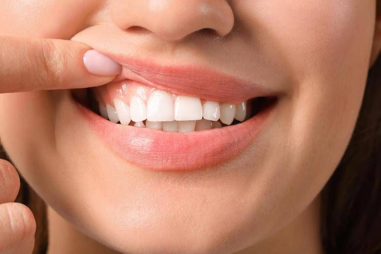 Salute 'in 70% persone con autismo problemi a denti e gengive', parodontologi in campo