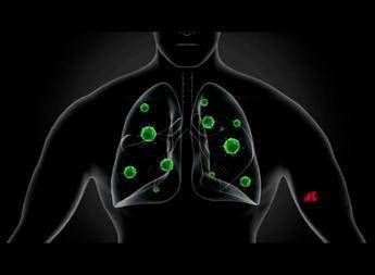 Msd presenta primo vaccino contro polmonite specifico per over 65