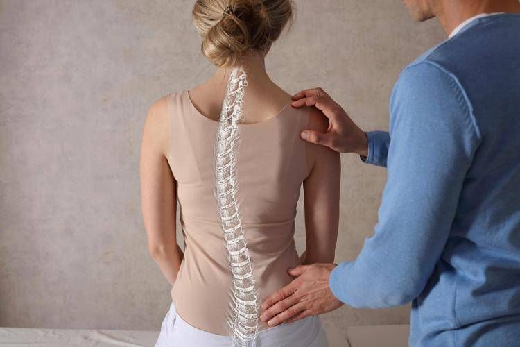 Scoliosi dell'adulto, tutte le novità dai trattamenti alla chirurgia