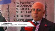 Oncologia, Ascierto (Istituto Pascale): “La prevenzione è la nostra migliore arma contro il melanoma e i tumori rari della pelle”