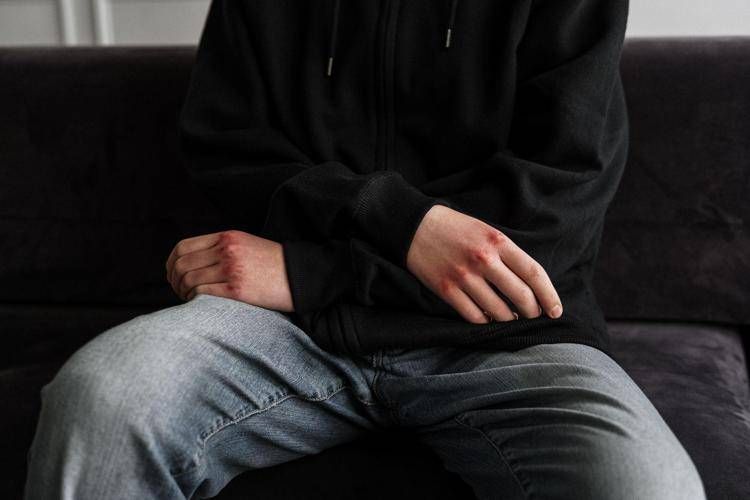 Codice Rosso: la pena è troppo alta? Udienza alla Consulta