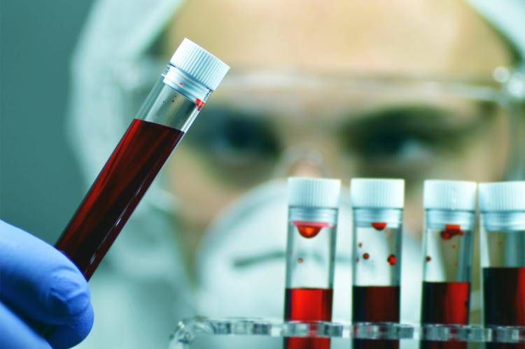Tumori, Ue approva terapia per adulti con leucemia linfatica cronica refrattaria