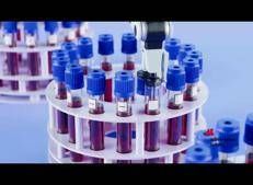 Aids: terapie antiretrovirali in Hiv garantiscono sopravvivenza e qualità di vita