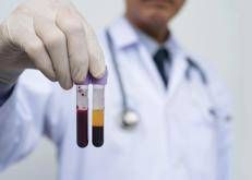 Provette di sangue - (Foto Adobe)