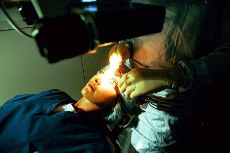 OPERAZIONE OCULISTICA CON LASER. PH. DEL PUPPO/FOTOGRAMMA VISITA MEDICA DALL'OCULISTA PER FARE OCCHIALI DA VISTA (Silvano Del Puppo/Fotogramma, MILANO - 1993-01-31) - FOTOGRAMMA