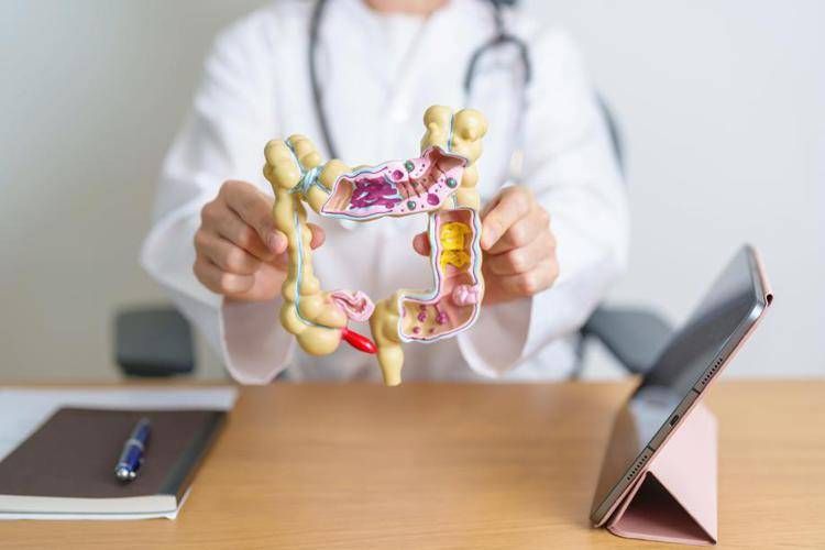 Tumori, Garufi (San Camillo): “Il tumore del colon retto si può prevenire ma l’adesione agli screening è troppo bassa”