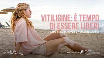 Salute, Giornata vitiligine: al via campagna 'Oltre falsi miti verso nuove possibilit