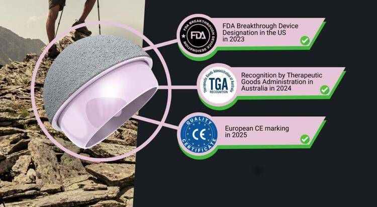 Il rivestimento in ceramica della protesi - Biolox