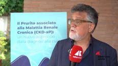 De Nicola (SIN): Mi auguro che Difelikefalin sia un farmaco che sarà prescrivibile direttamente da tutti i centri di dialisi