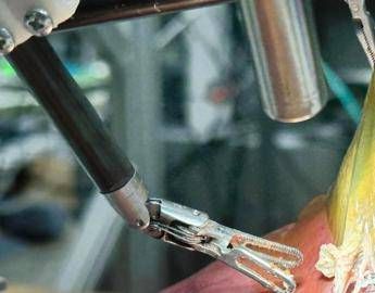 Il 'dottor robot' opera da solo, primo intervento senza aiuto uma