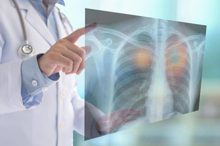 Fine vita, oncologi: "No a Comitato nazionale e a esclusione Ssn, subito confronto"