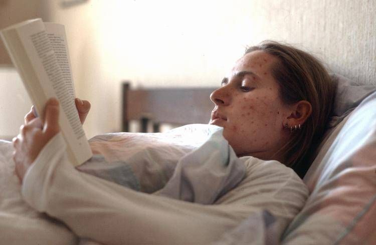 Donna con morbillo - Fotogramma / Ipa