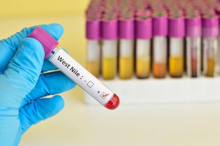 Virus West Nile, provette - 123RF