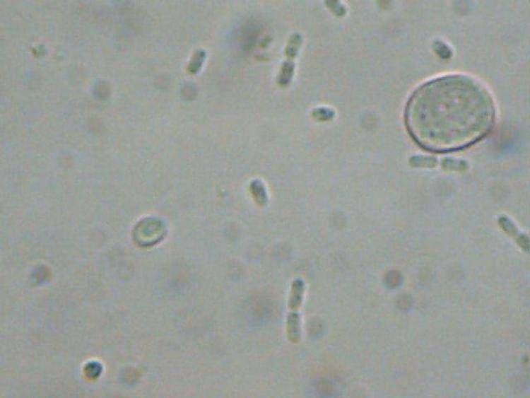 Batteri al microscopio - (Wikipedia)