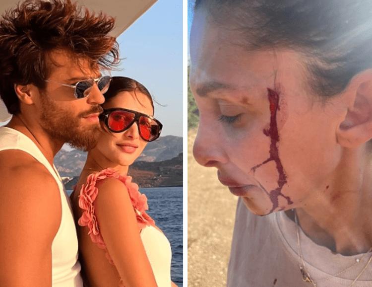Can Yaman, la fidanzata Sara Bluma denuncia le violenze dell'ex. L'attore: "Ti amo"