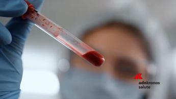 Giornata epatiti, esperti: 