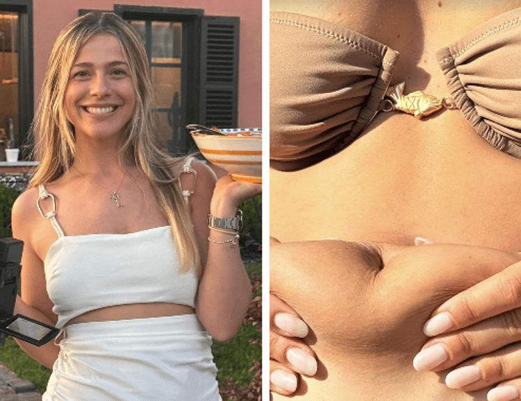Ultimo, Jacqueline mostra la pancia a 8 mesi dal parto: "Amate il vostro corpo"