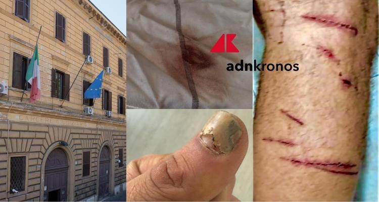 "Picchiato e sequestrato per due giorni da altri detenuti a Regina Coeli", la denuncia choc