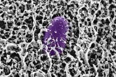 Scoperta del MIT: il muco contiene molecole che bloccano l'infezione da Salmonella