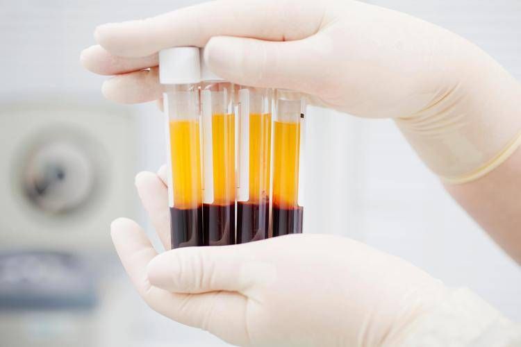 Manovra, Associazione immunodeficienze primitive: 