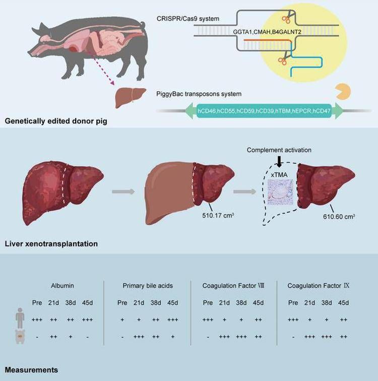 Le fasi del trapianto - Journal of Hepatology / Zhang et al