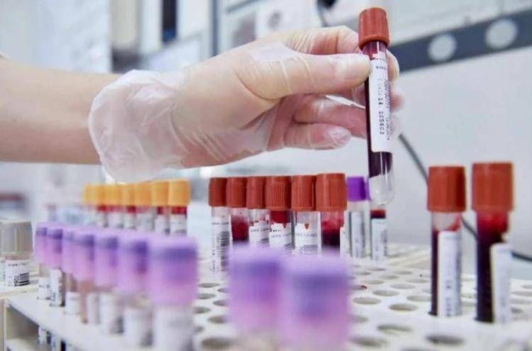 ricerca_generica_comm image Tumori, cancro vescica: 70% pazienti libero da malattia a 2 anni con terapie perioperatorie