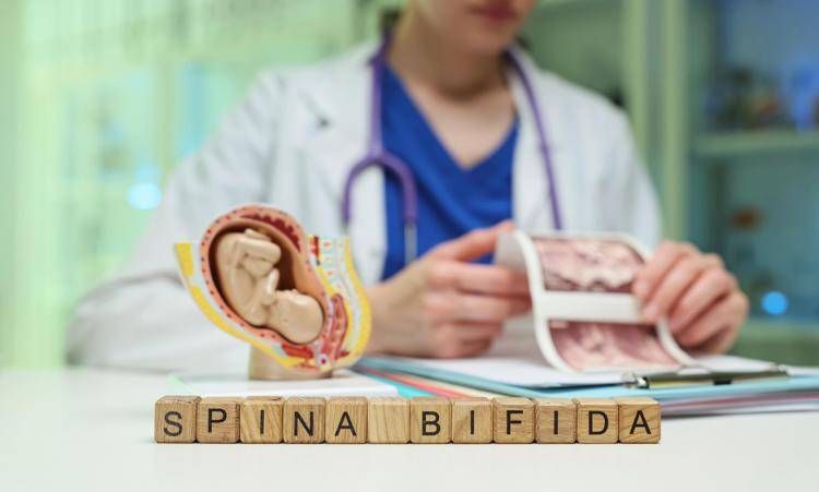 spinabifida_free image Giornata spina bifida, da prevenzione a nuove tecniche chirurgiche