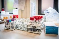  Campioni di sangue, provette (Milano - 2020-05-15, Marco Passaro)