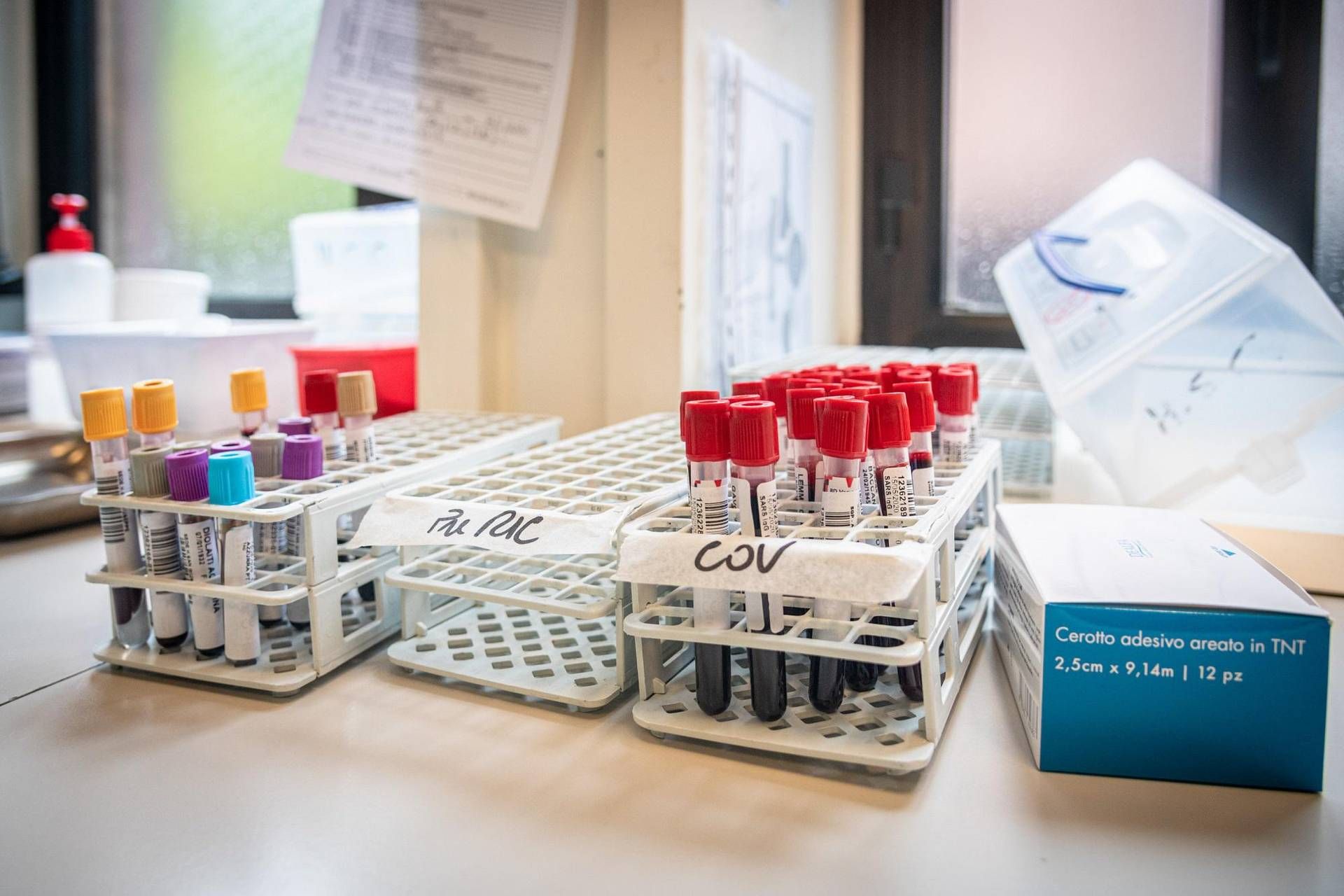 Medicina di laboratorio, 'un semplice esame per scoprire in anticipo le patologie'