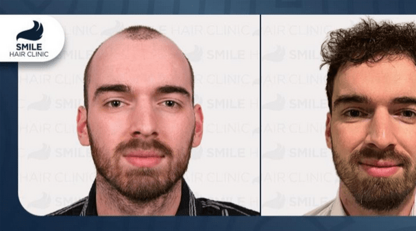 screenshot 2025 11 12 110303