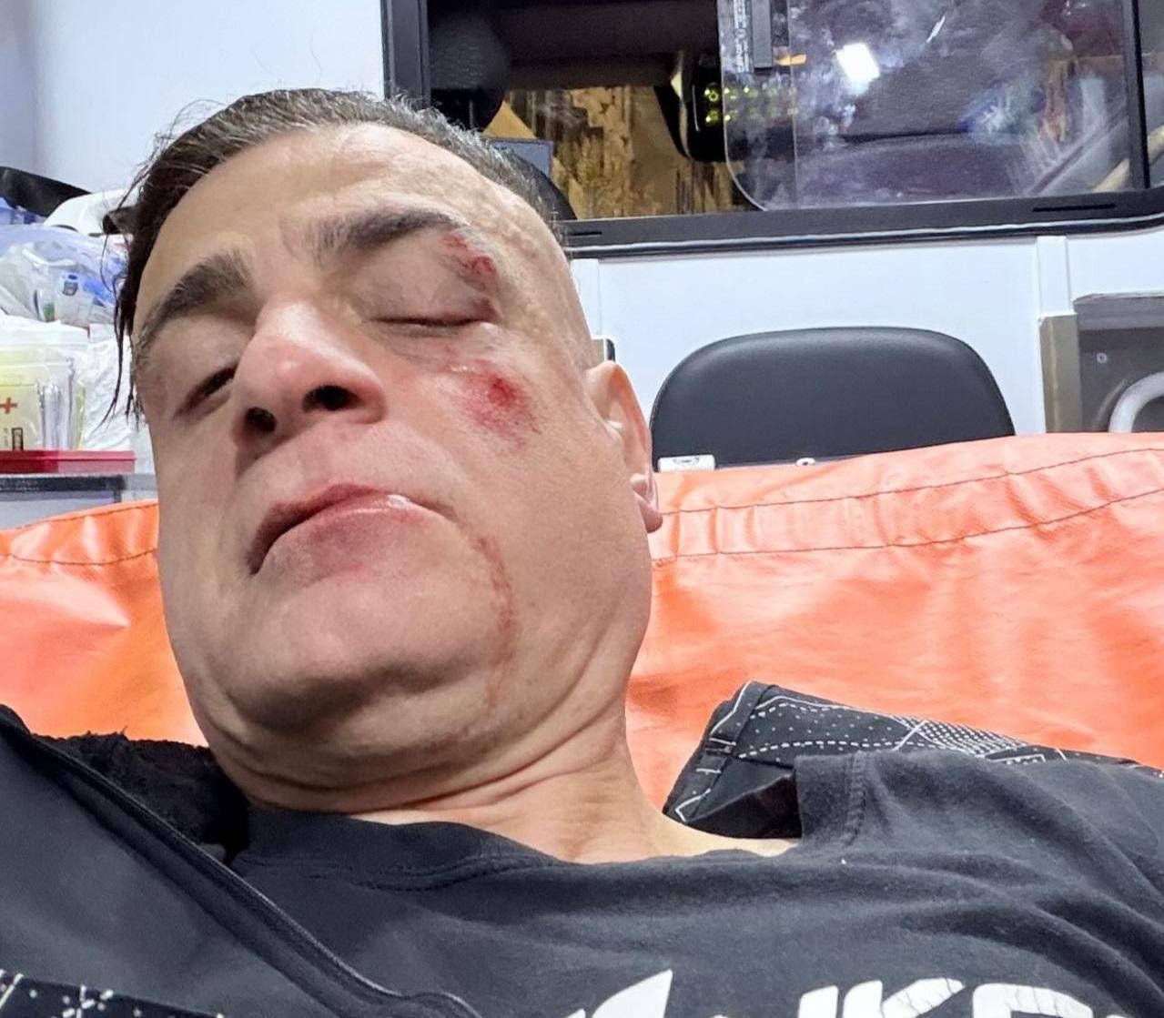 Cicalone aggredito in metro a Roma: come sta lo youtuber