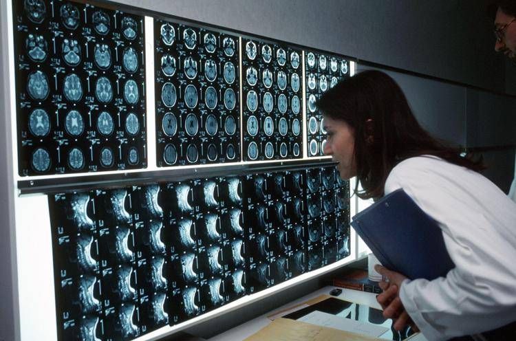 Cancro, 4 sintomi 'insoliti' che bisogna conoscere: parola di oncologo