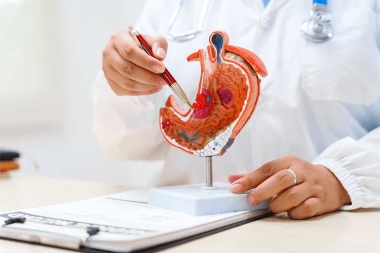 Tumore allo stomaco, pazienti: 