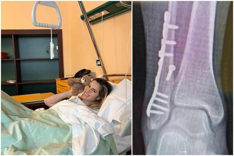 Thais Wiggers dopo l'operazione - Instagram