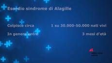 Sindrome di Alagille, ok di Aifa a rimborsabilità trattamento per  prurito colestatico in sindrome di Alagille