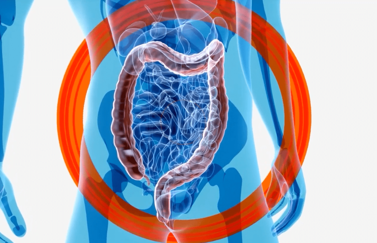 Salute, nuovo rapporto sulla stitichezza un’Italia 