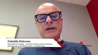 Patruno (Sidapa), 'terapie innovative efficaci per eczema cronico delle mani'