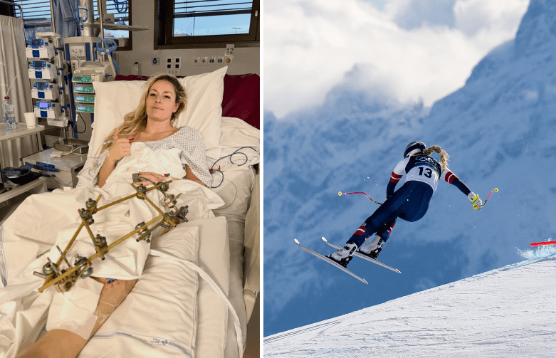 Vonn, la prima foto dopo l’infortunio a Cortina. Come sta Lindsey