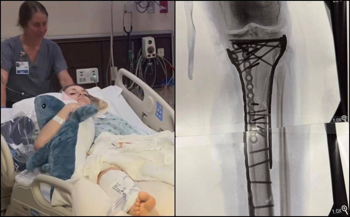 sui social le foto delle lastre