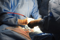 Trapianti, Ordine psicologi: 