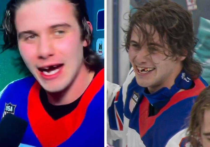 Senza denti ma con oro, Hughes eroe dell’hockey Usa a Milano Cortina