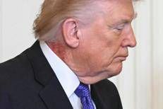 Trump e la foto con il collo irritato
