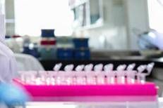 provette laboratorio afp